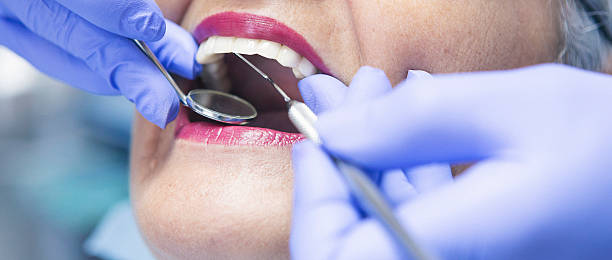Best Emergency Dental Extractions in Nokesville, VA